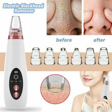 Load image into Gallery viewer, USB Blackhead Black Dot Remover Face Pore Vacuum Skin Care Acne Pore Cleaner Pimple Removal Vacuum Suction Tools